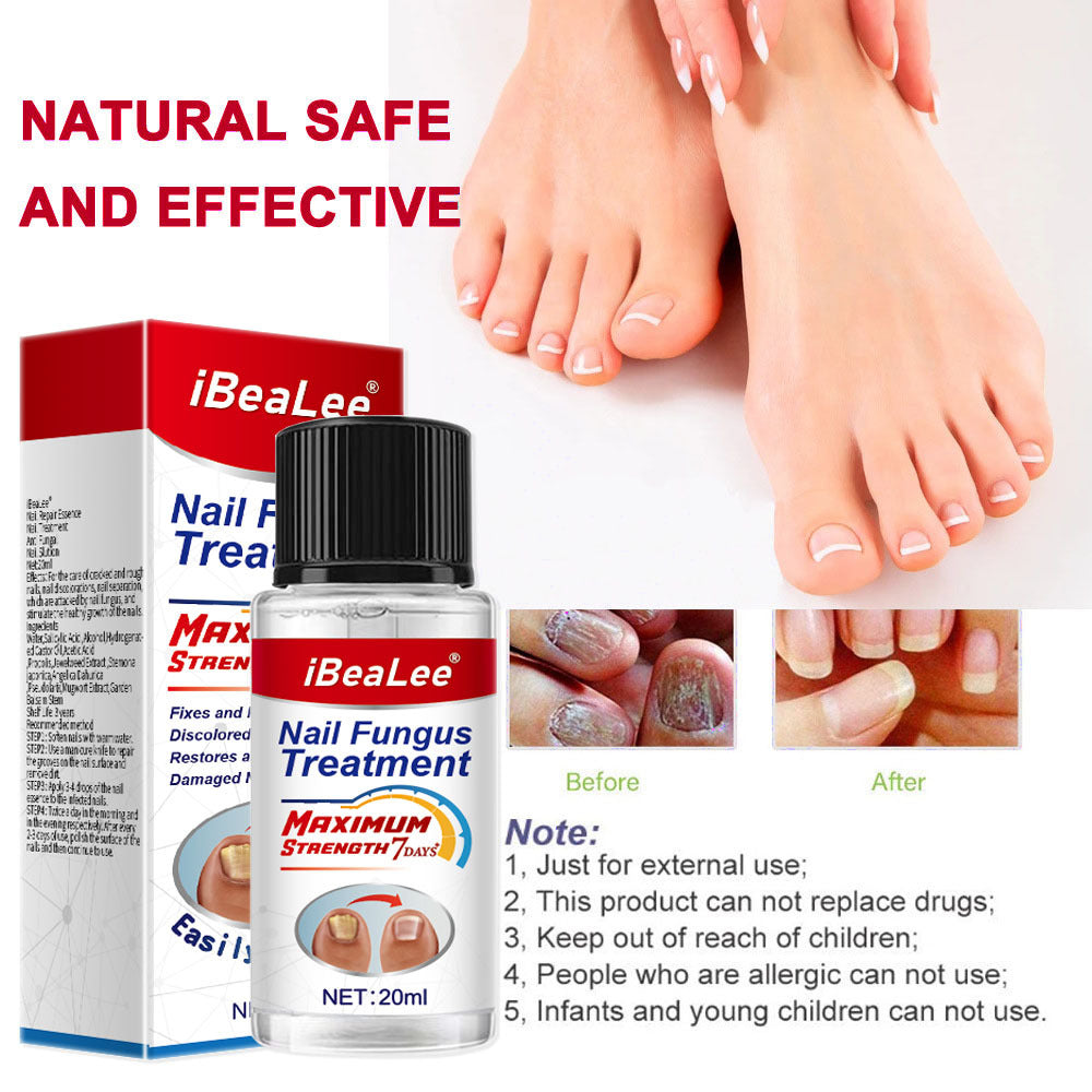 Thickening Of Special Bacteriostatic Liquid For Onychomycosis